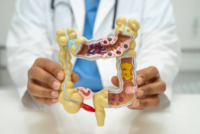 intestine-appendix-and-digestive-system-doctor-h-2025-02-25-23-18-18-utc (1)