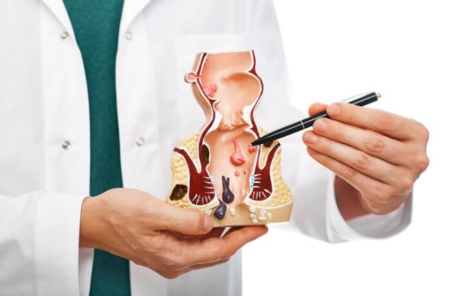 treatment-of-rectal-diseases-hemorrhoid-proctolo-2025-04-01-20-38-42-utc (1)